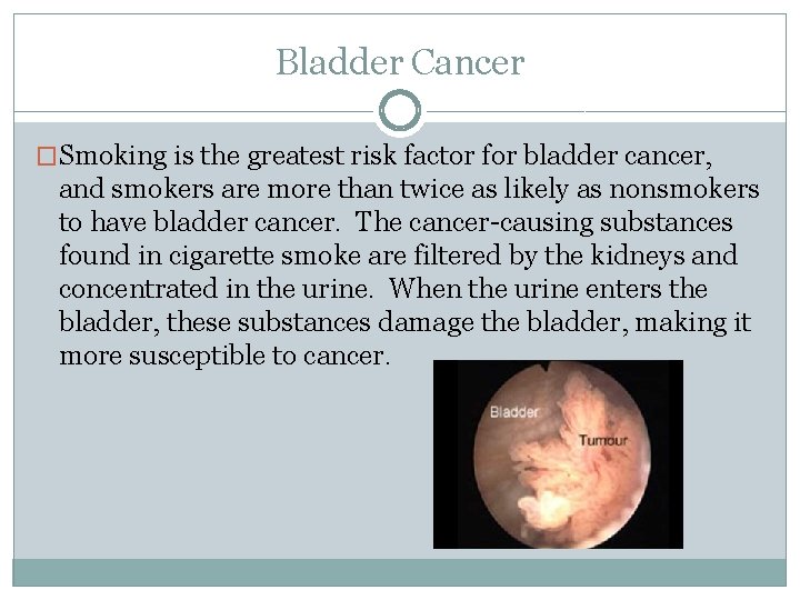 Bladder Cancer �Smoking is the greatest risk factor for bladder cancer, and smokers are