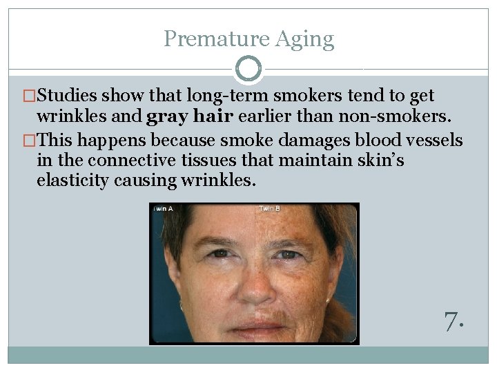 Premature Aging �Studies show that long-term smokers tend to get wrinkles and gray hair