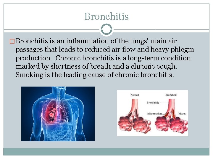 Bronchitis � Bronchitis is an inflammation of the lungs’ main air passages that leads