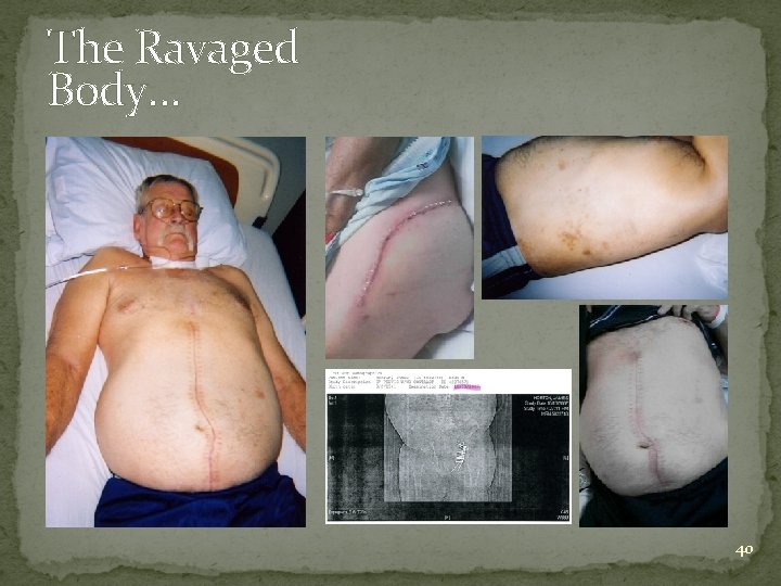 The Ravaged Body… 40 