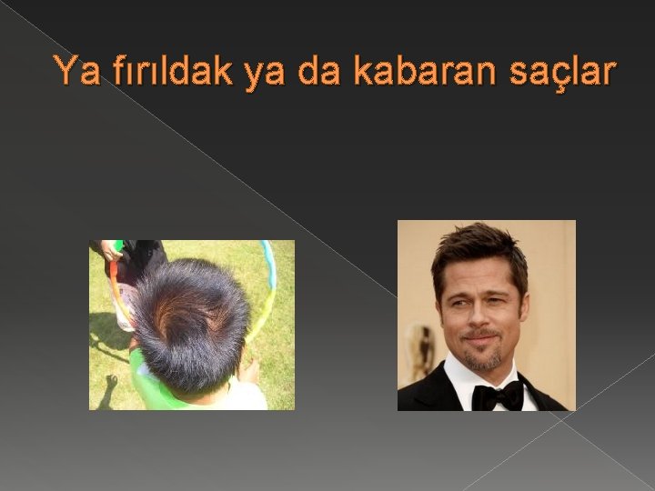 Ya fırıldak ya da kabaran saçlar 