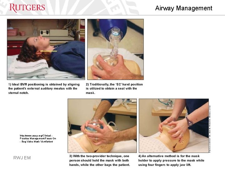 Airway Management http: //www. acep. org/Clinical--Practice-Management/Focus-On--Bag-Valve-Mask-Ventilation/ RWJ EM 