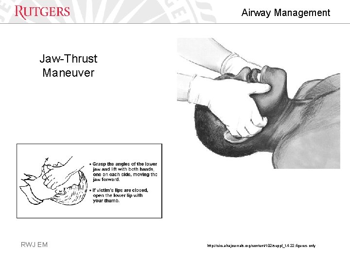 Airway Management Jaw-Thrust Maneuver RWJ EM http: //circ. ahajournals. org/content/102/suppl_1/I-22. figures-only 