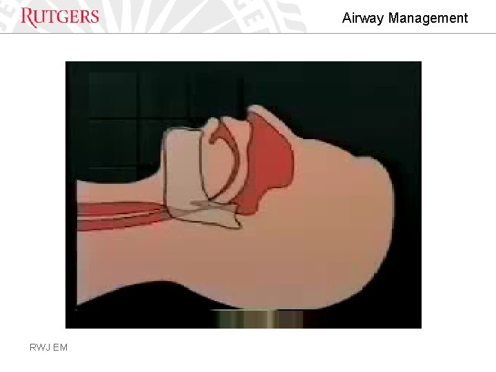 Airway Management RWJ EM 