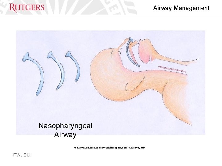 Airway Management Nasopharyngeal Airway http: //www. aic. cuhk. edu. hk/web 8/Nasopharyngeal%20 airway. htm RWJ