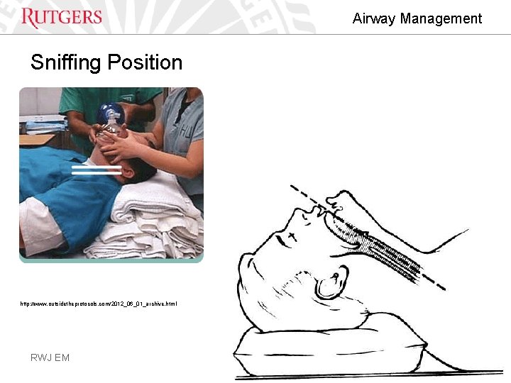 Airway Management Sniffing Position http: //www. outsidetheprotocols. com/2012_06_01_archive. html RWJ EM 