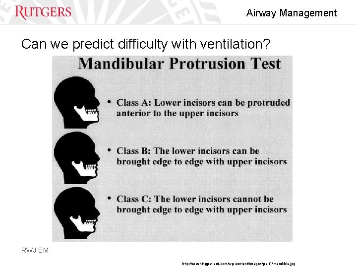 Airway Management Can we predict difficulty with ventilation? RWJ EM http: //crashingpatient. com/wp-content/images/part 1/mandible.