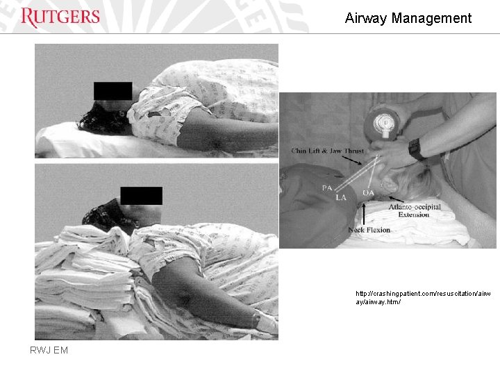 Airway Management http: //crashingpatient. com/resuscitation/airw ay/airway. htm/ RWJ EM 
