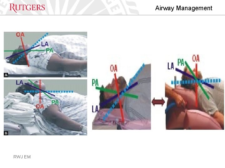Airway Management RWJ EM 