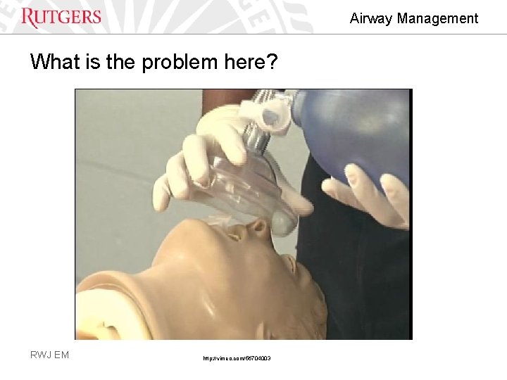 Airway Management What is the problem here? RWJ EM http: //vimeo. com/56704003 