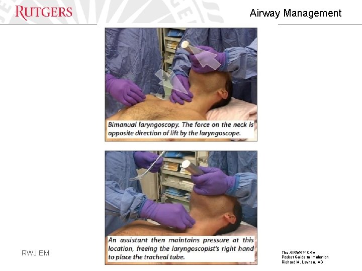 Airway Management RWJ EM The AIRWAY • CAM Pocket Guide to Intubation Richard M.