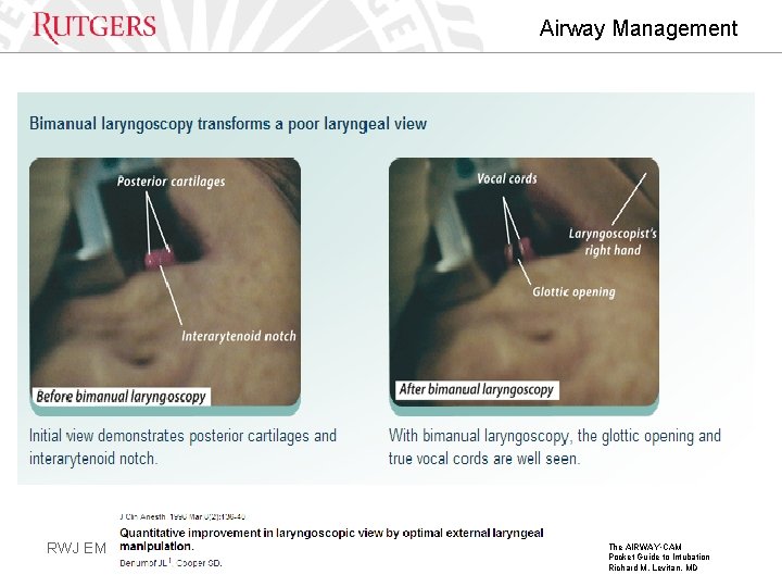 Airway Management RWJ EM The AIRWAY • CAM Pocket Guide to Intubation Richard M.