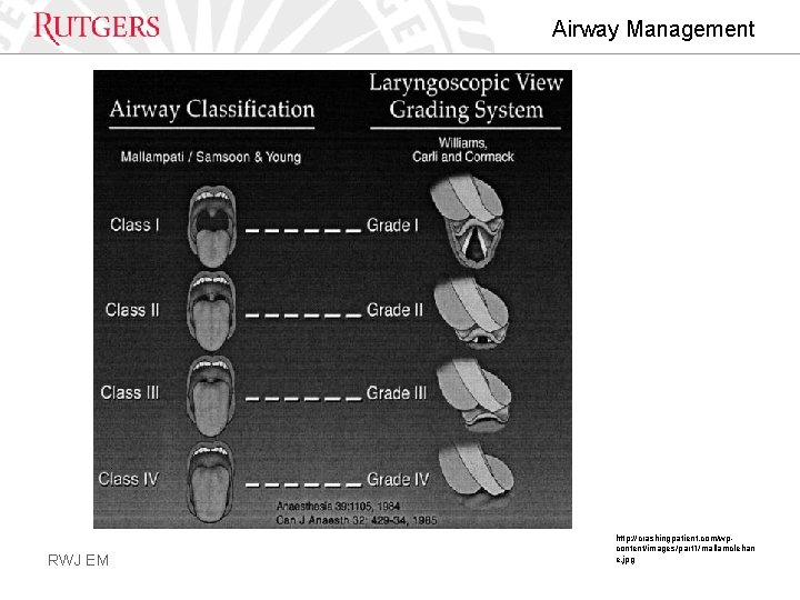 Airway Management RWJ EM http: //crashingpatient. com/wpcontent/images/part 1/mallamclehan e. jpg 