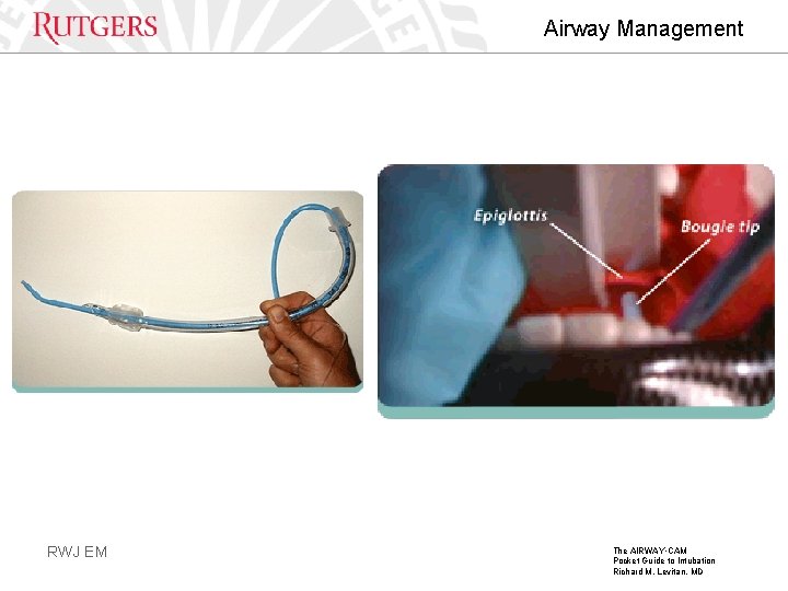 Airway Management RWJ EM The AIRWAY • CAM Pocket Guide to Intubation Richard M.