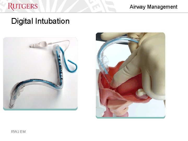 Airway Management Digital Intubation RWJ EM 