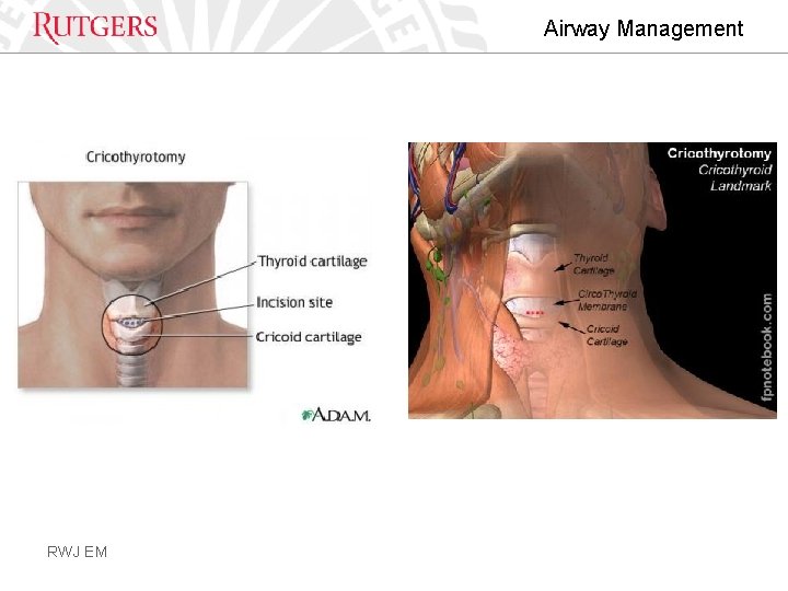 Airway Management RWJ EM 