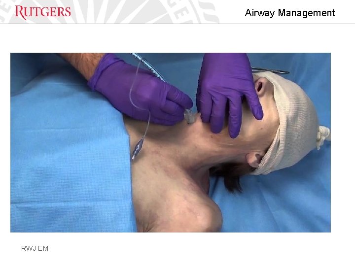Airway Management RWJ EM 
