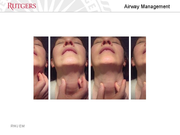 Airway Management RWJ EM 