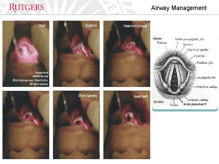 Airway Management RWJ EM 