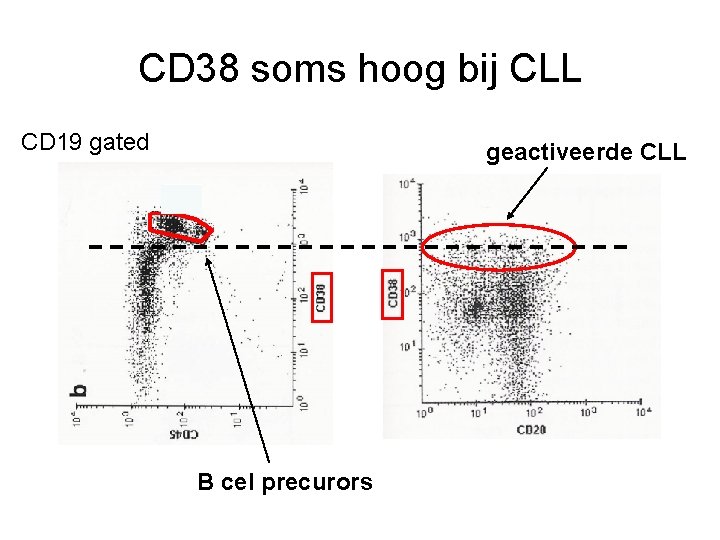 CD 38 soms hoog bij CLL CD 19 gated geactiveerde CLL R 2 B