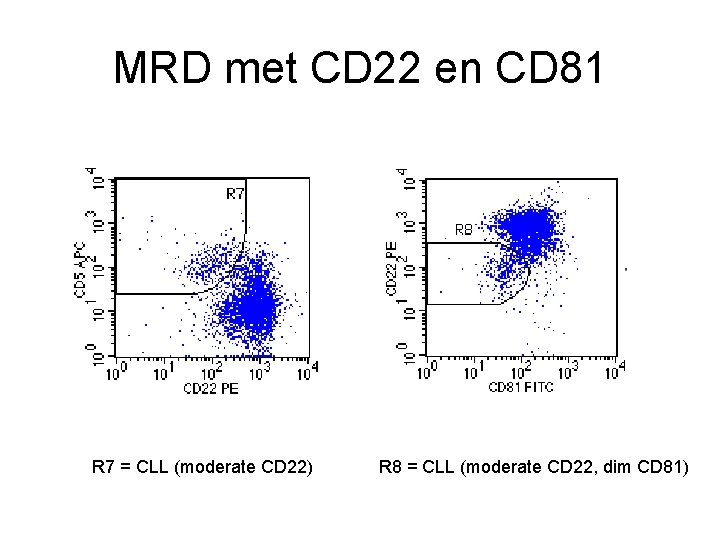 MRD met CD 22 en CD 81 R 7 = CLL (moderate CD 22)