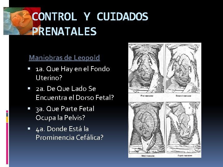 CONTROL Y CUIDADOS PRENATALES Maniobras de Leopold 1 a. Que Hay en el Fondo