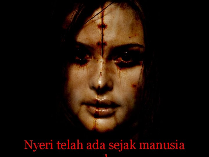 Nyeri telah ada sejak manusia 
