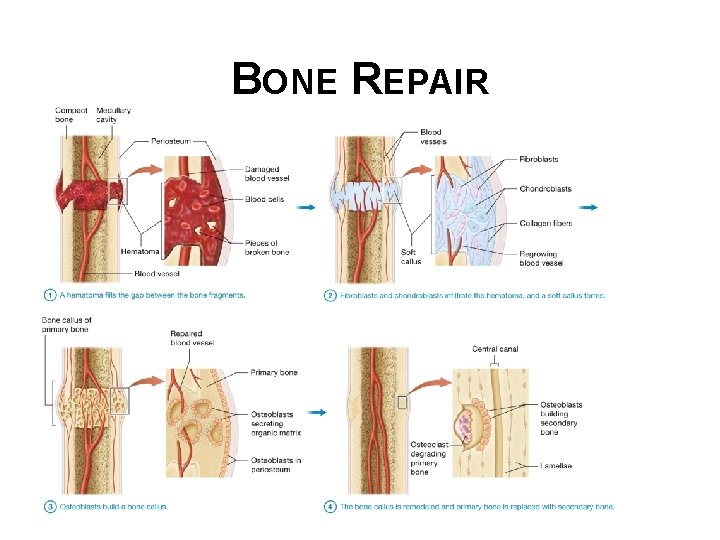 BONE REPAIR 