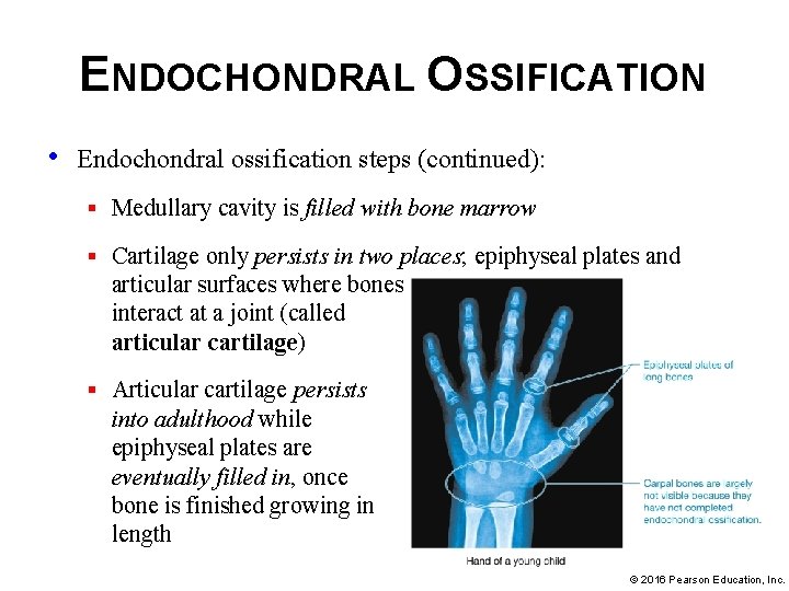 ENDOCHONDRAL OSSIFICATION • Endochondral ossification steps (continued): § Medullary cavity is filled with bone