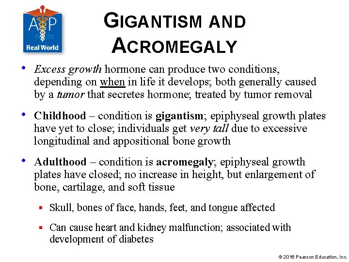 GIGANTISM AND ACROMEGALY • Excess growth hormone can produce two conditions, depending on when