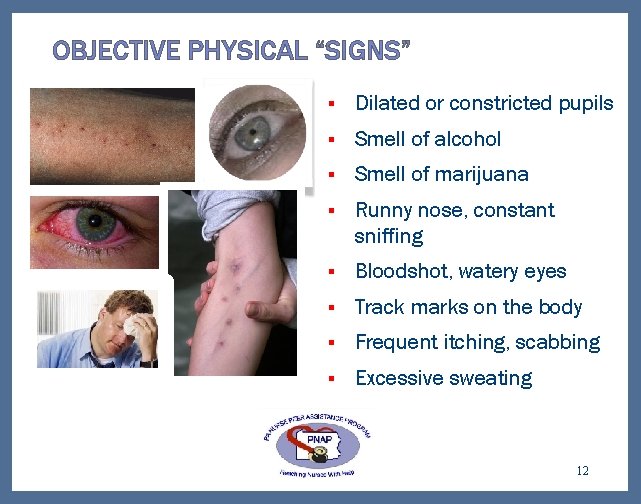 OBJECTIVE PHYSICAL “SIGNS” § Dilated or constricted pupils § Smell of alcohol § Smell