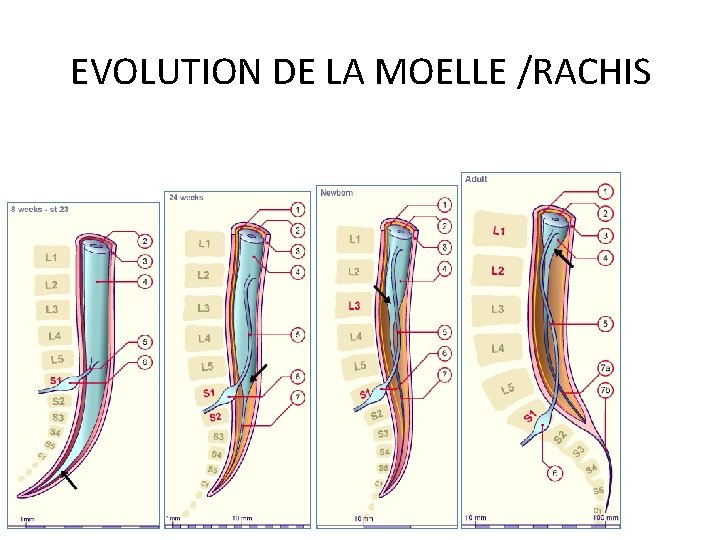 EVOLUTION DE LA MOELLE /RACHIS 