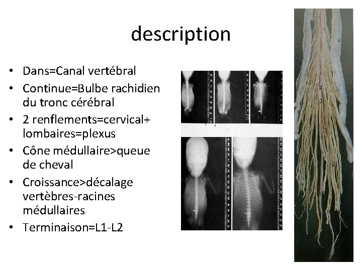 description • Dans=Canal vertébral • Continue=Bulbe rachidien du tronc cérébral • 2 renflements=cervical+ lombaires=plexus