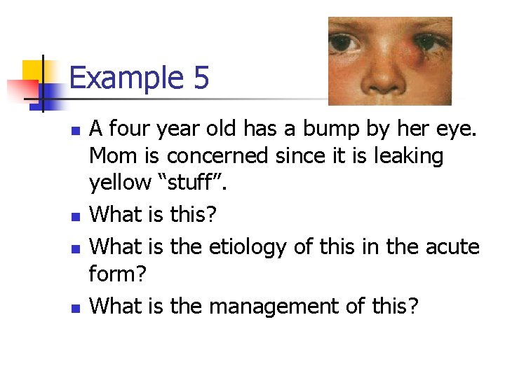 Example 5 n n A four year old has a bump by her eye.