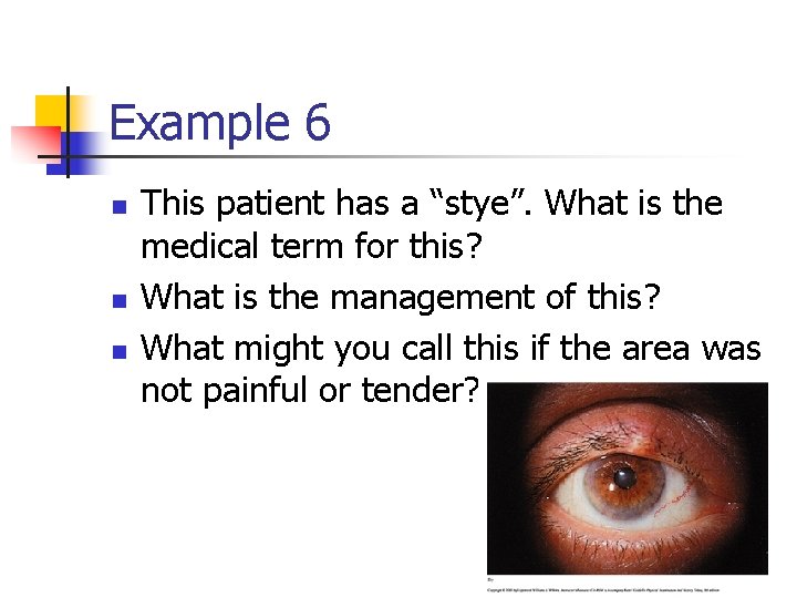 Example 6 n n n This patient has a “stye”. What is the medical