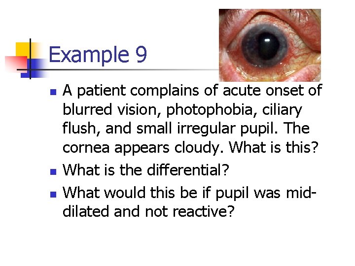 Example 9 n n n A patient complains of acute onset of blurred vision,