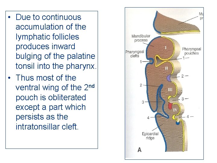  • Due to continuous accumulation of the lymphatic follicles produces inward bulging of