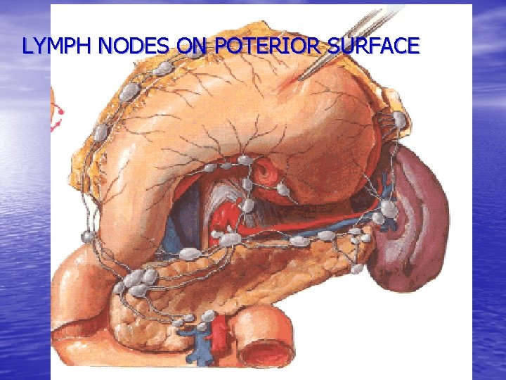 LYMPH NODES ON POTERIOR SURFACE 