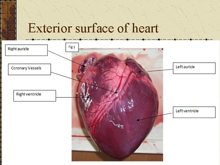 Exterior surface of heart 