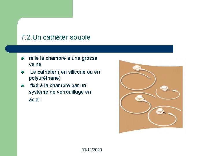 7. 2. Un cathéter souple relie la chambre à une grosse veine Le cathéter 7. 2. Un cathéter souple relie la chambre à une grosse veine Le cathéter