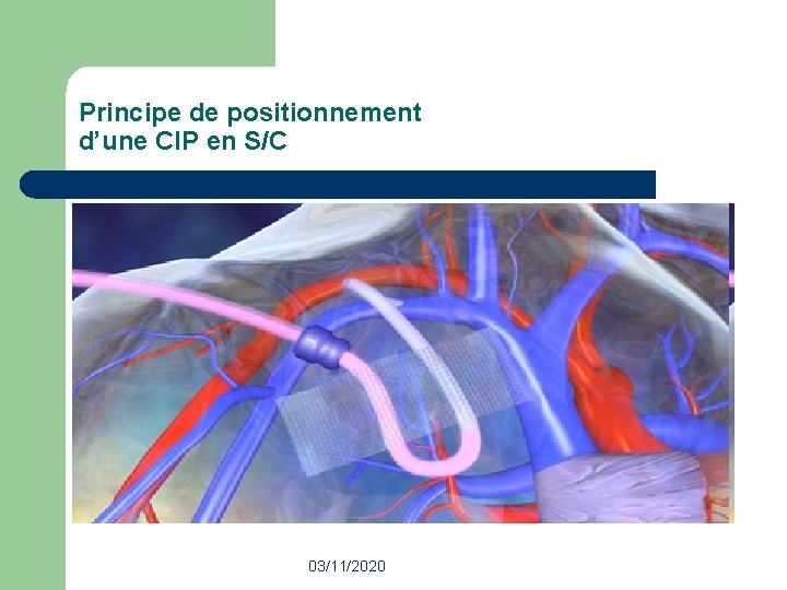 Principe de positionnement d’une CIP en S/C 03/11/2020 