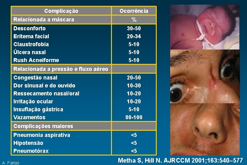 Complicação Relacionada a máscara Desconforto Eritema facial Claustrofobia Úlcera nasal Rush Acneiforme Ocorrência %