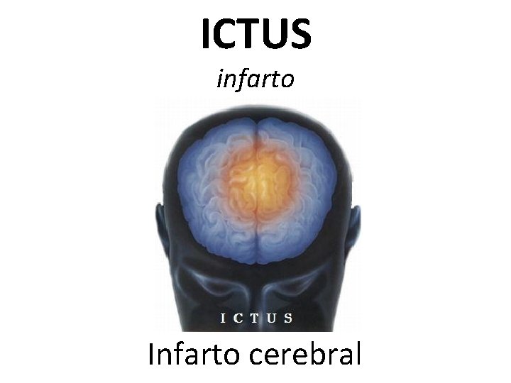 ICTUS infarto Infarto cerebral 