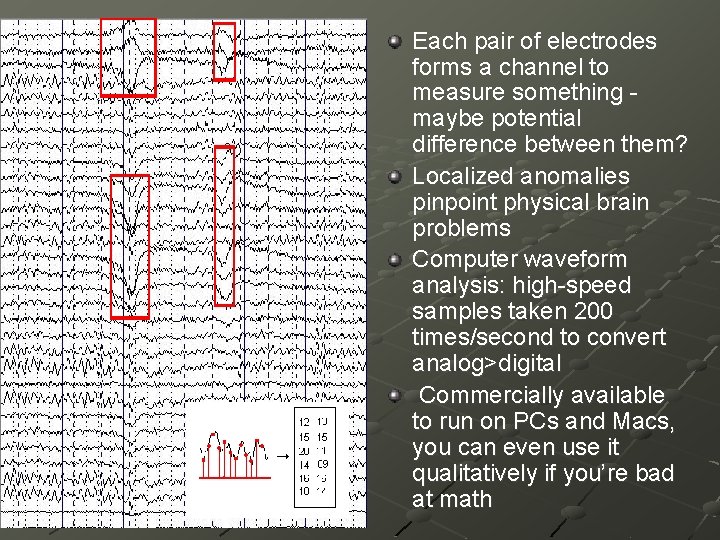 Each pair of electrodes forms a channel to measure something maybe potential difference between