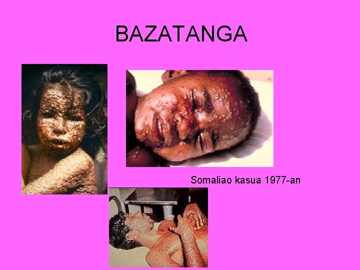 BAZATANGA Somaliao kasua 1977 -an 