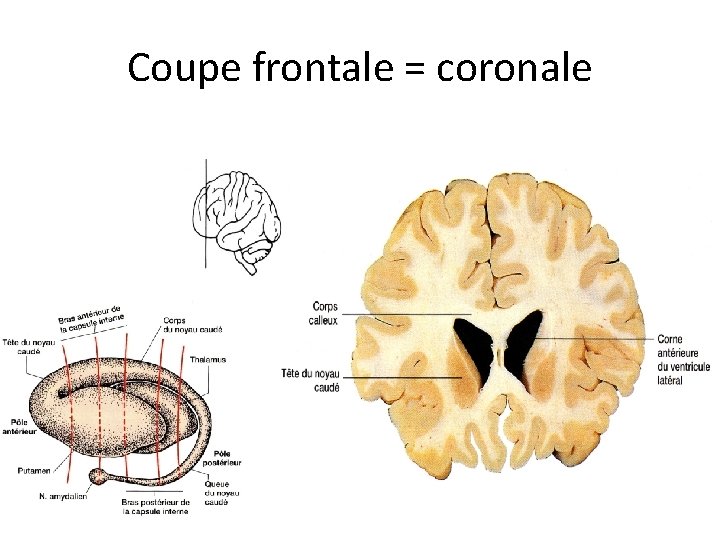Coupe frontale = coronale 