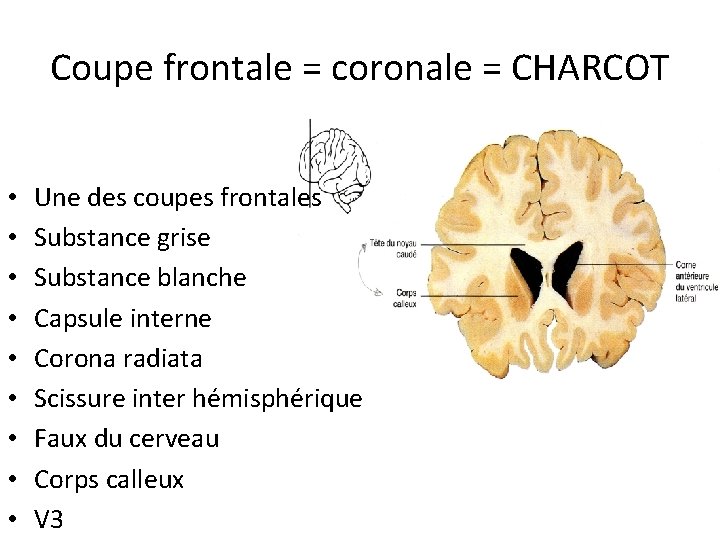 Coupe frontale = coronale = CHARCOT • • • Une des coupes frontales Substance