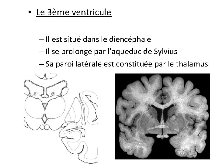  • Le 3ème ventricule – Il est situé dans le diencéphale – Il