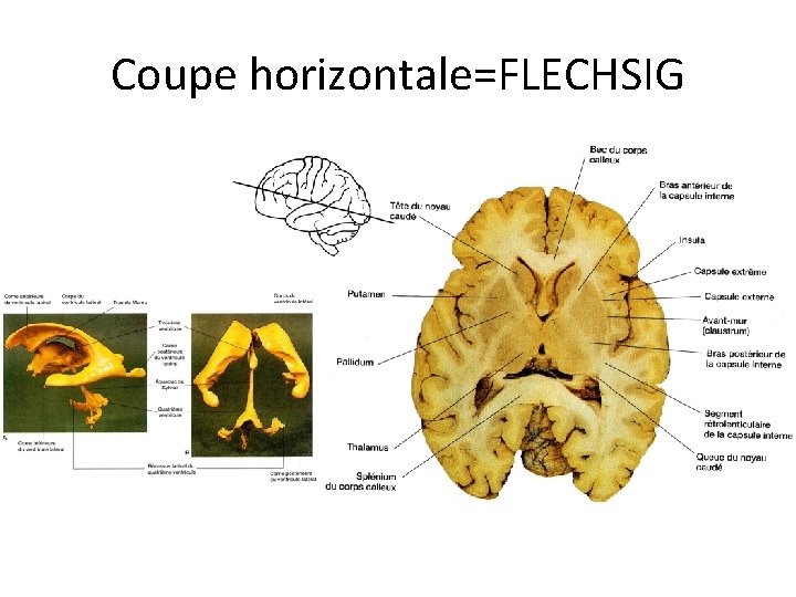 Coupe horizontale=FLECHSIG 