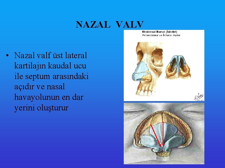 NAZAL VALV • Nazal valf üst lateral kartilajın kaudal ucu ile septum arasındaki açıdır